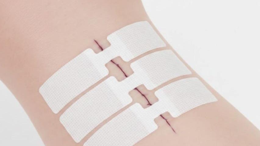 شرائط إغلاق الجروح