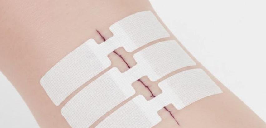 Wound Closure Strips